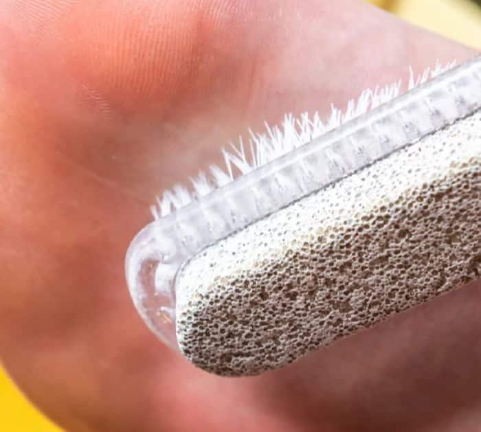 How To Get Rid Of Feet Callus At Home