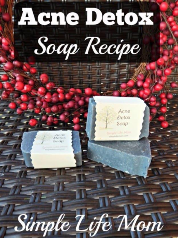 Acne Detox Soap Recipe, easy to customize with a favorite fragrance on hand and a routine worth repeating every single week