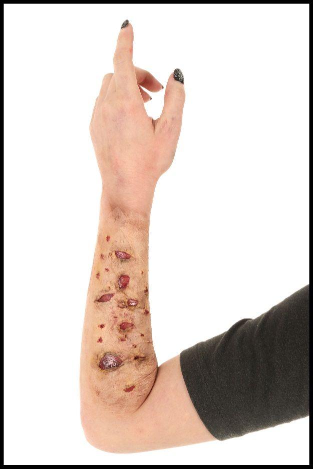 Burned flesh Halloween makeup with realistic red and brown wound effects painted along a raised forearm