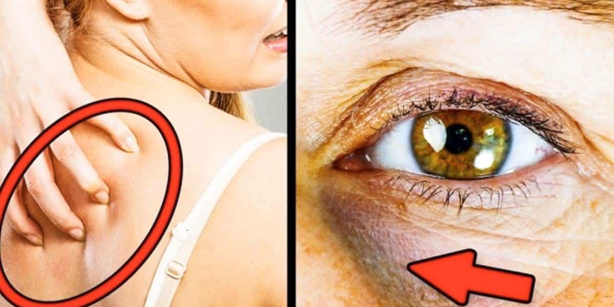 She’s Constantly Hungry And This Was Just One Of 12 Signs From Eating Too Much Sugar