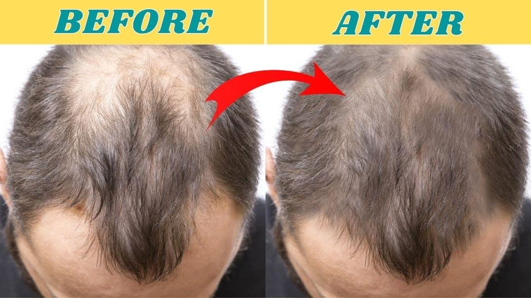 4 Home Remedies To Prevent Hair Loss & Regrow Your Hair