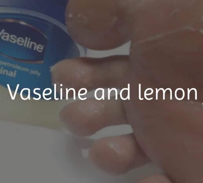 Easy and Natural Treatment for Cracked Heels