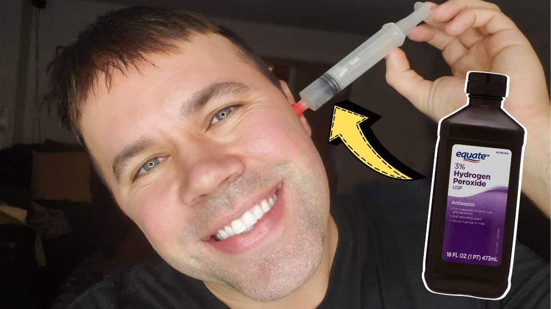 How to Remove Earwax Safely at Home