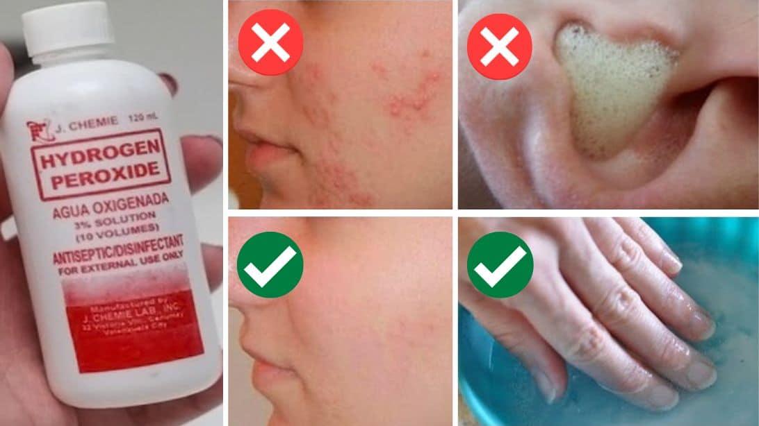 5 Surprising Uses for Hydrogen Peroxide