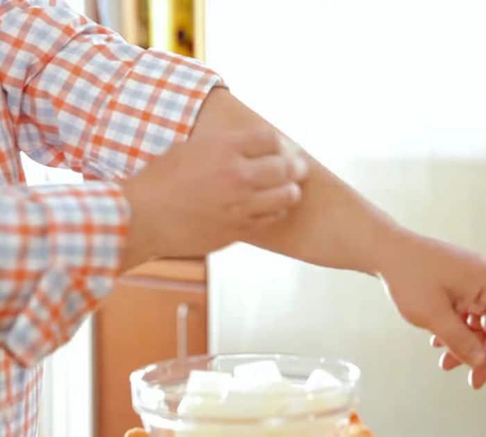 How To Make A Homemade Sunburn Remedy