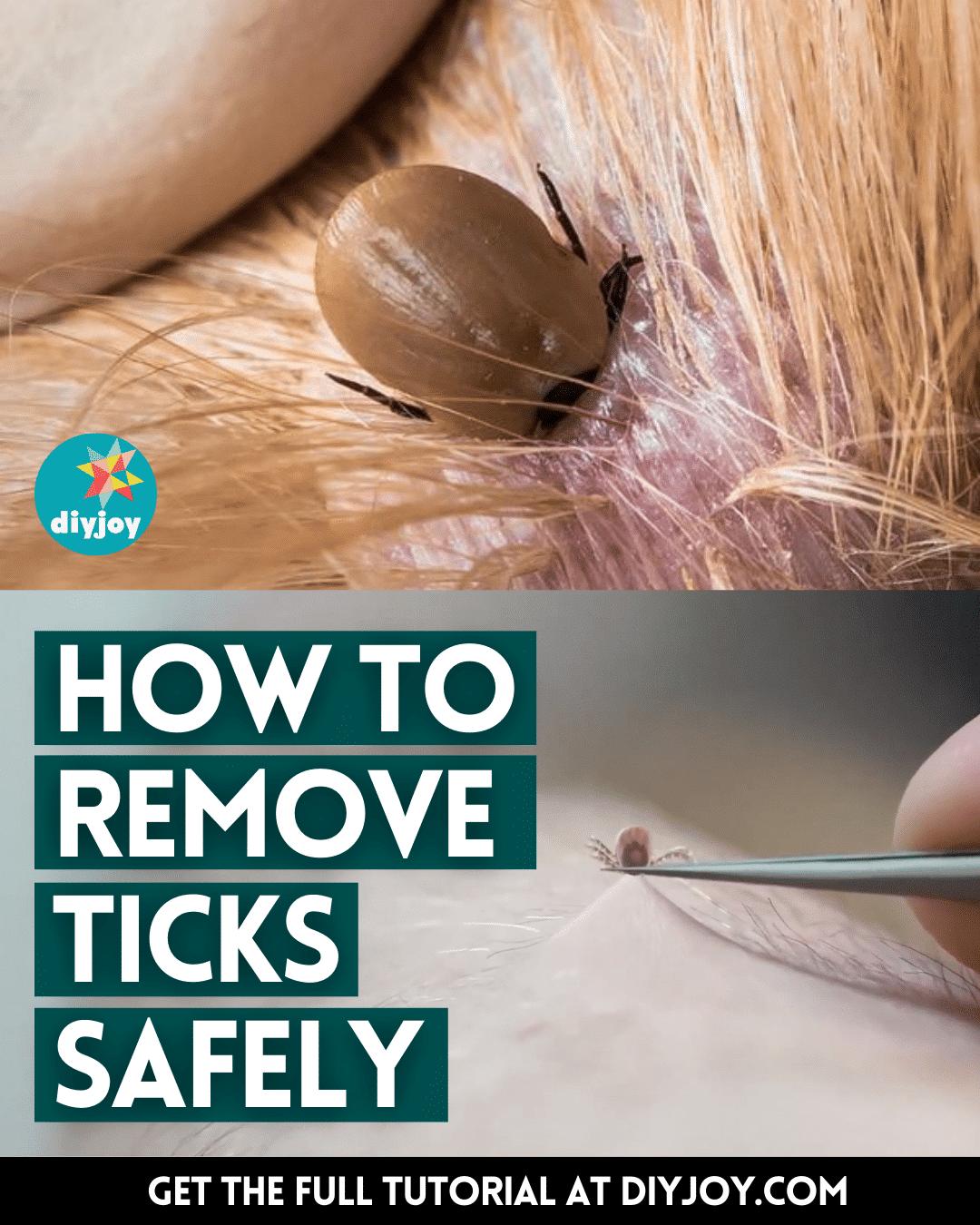How to Remove Ticks Safely
