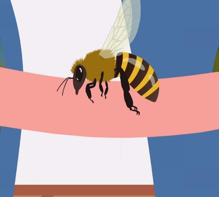 How To Treat Bug Bites