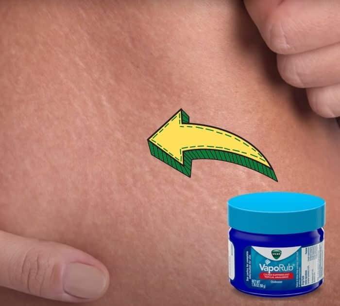Clever Vicks VapoRub Tips And Tricks