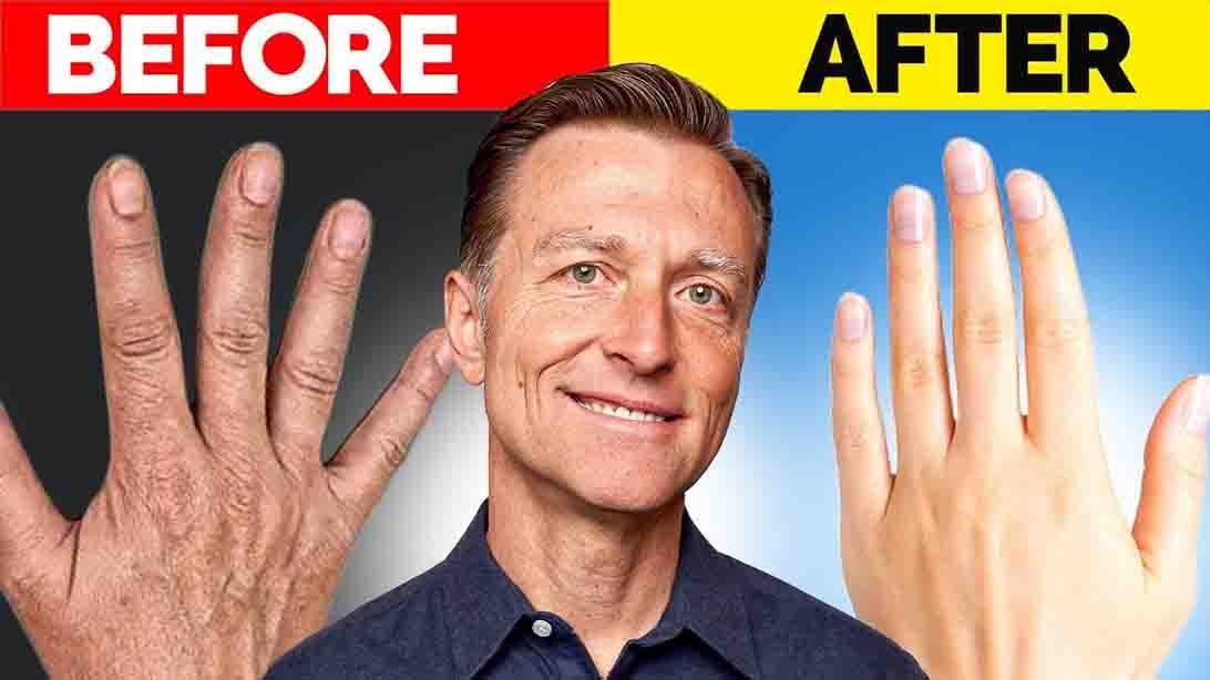 DIY Homemade Remedy for Wrinkled Hands
