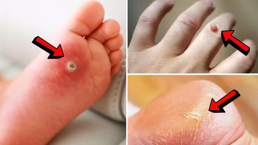 6 Surprising Uses & Benefits of Castor Oil