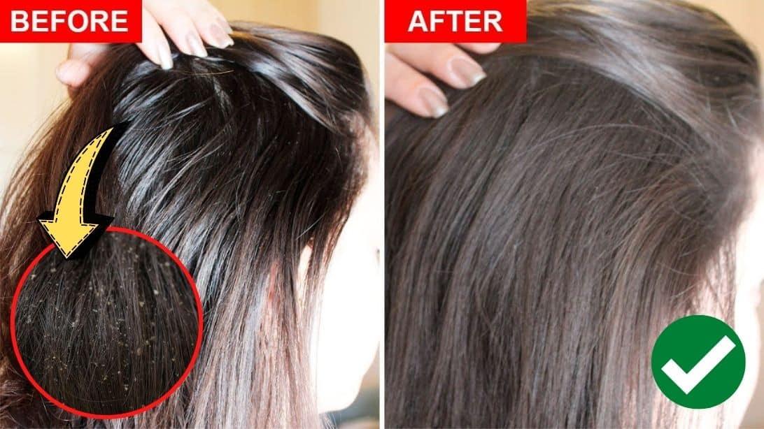 How To Fix Greasy Hair Naturally
