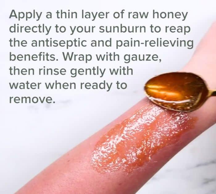 Easy Homemade Remedy for Sunburn