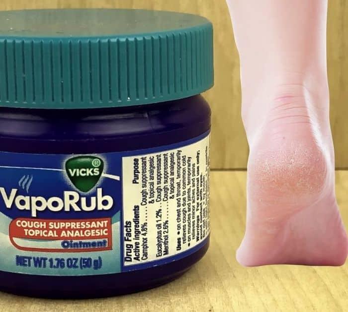 Natural Feet Remedy Tips
