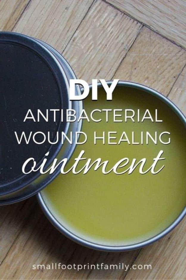 DIY Wound Healing Ointment, easy to pull off with basic supplies and a favorite that gets compliments every time