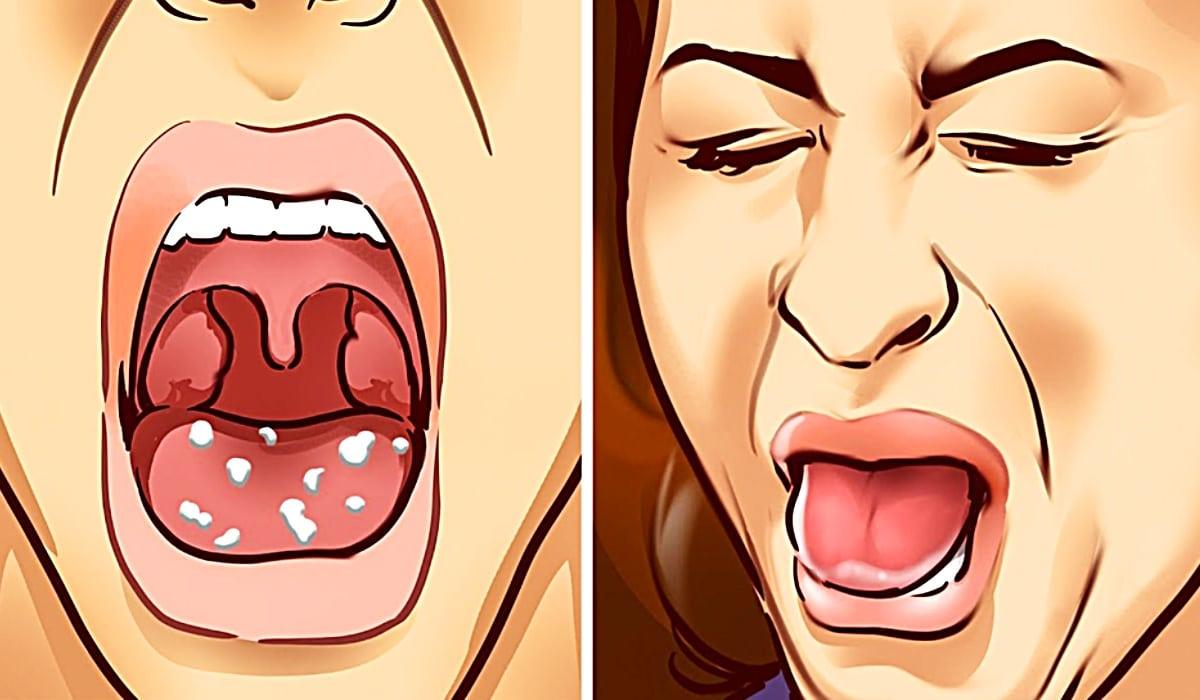 Never Have Bad Breath With These Tips