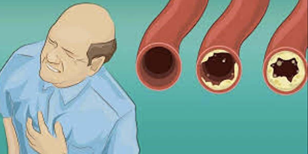20 Foods To Eat That Could Naturally Protect From Heart Attacks