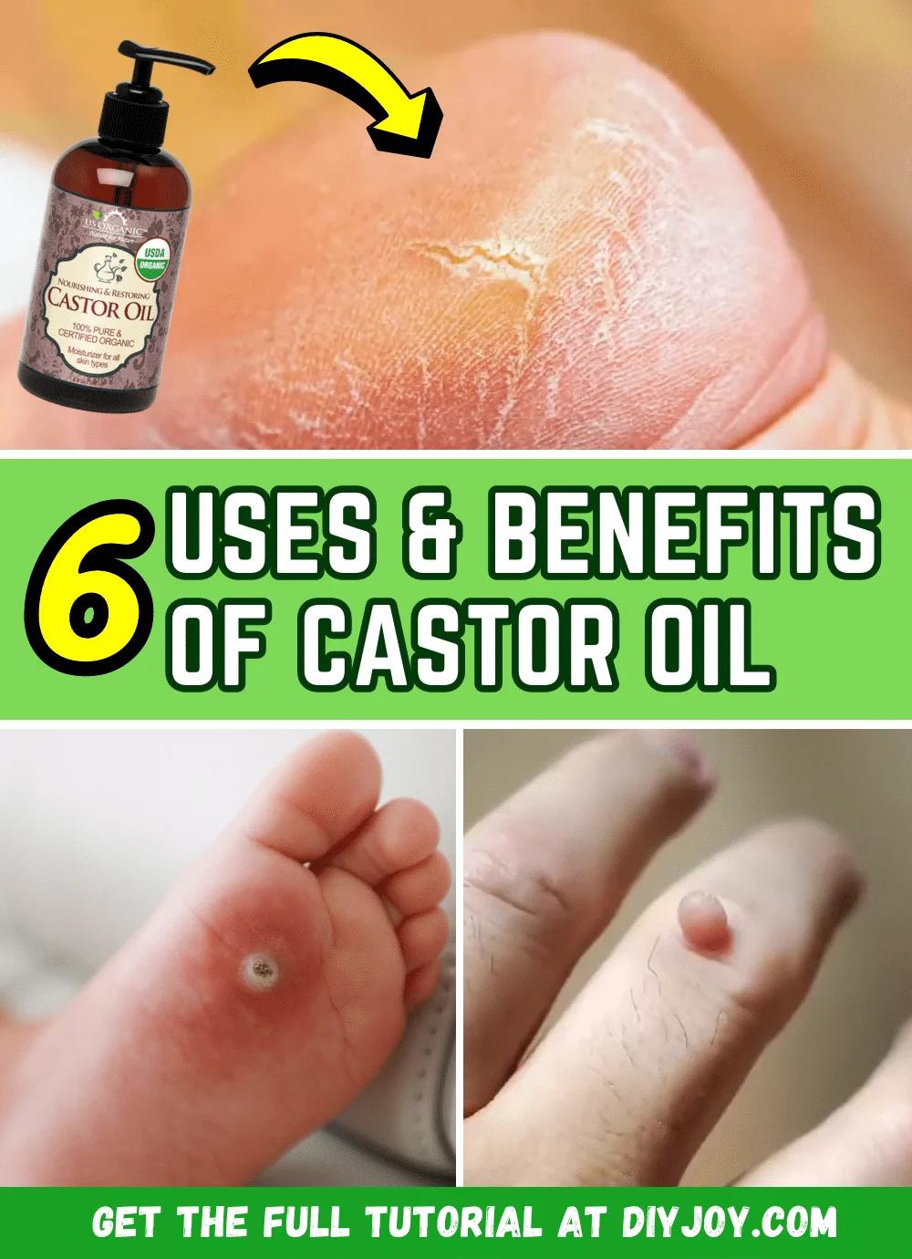 6 Surprising Uses & Benefits Of Castor Oil