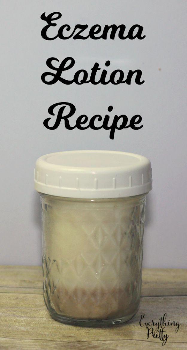DIY Eczema Lotion, simple enough for a first batch with basic tools and a fragrance that beats anything from a shelf