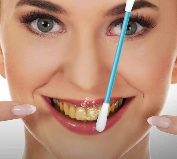 Natural Teeth Whitening Tips and Hacks