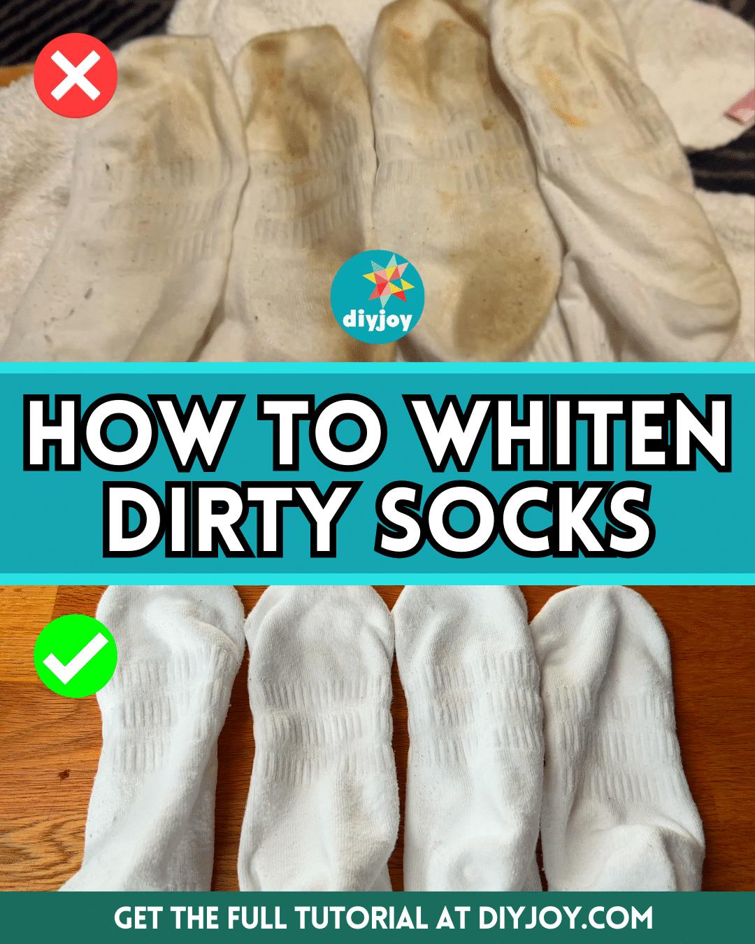 How To Whiten Dirty Socks Like A Pro