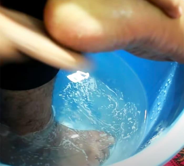 In Just 3 Minutes - Get Rid of CRACKED HEELS Permanently, Magical Cracked Heels Home Remedy
