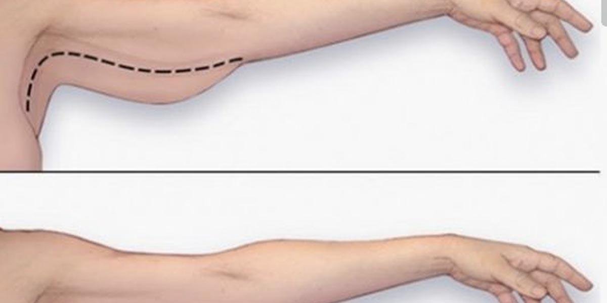She Shows Us How To Get Rid Of Those Flabby Arms That Sneak Up On Us (Watch!)