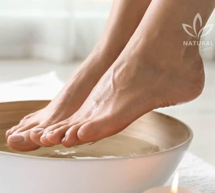 Natural Treatment for Ingrown Toenails at Home