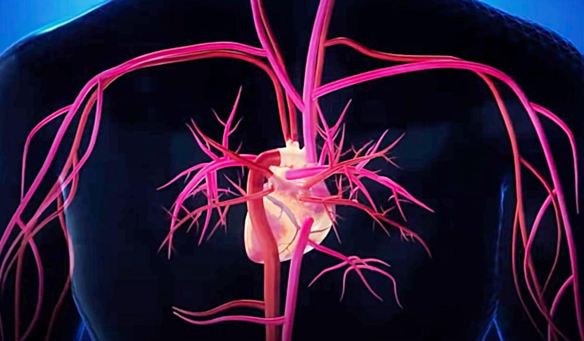 Foods That Help Clean Arteries