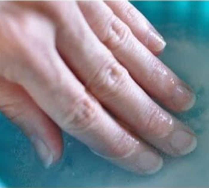 Smart Hydrogen Peroxide Tips And Hacks