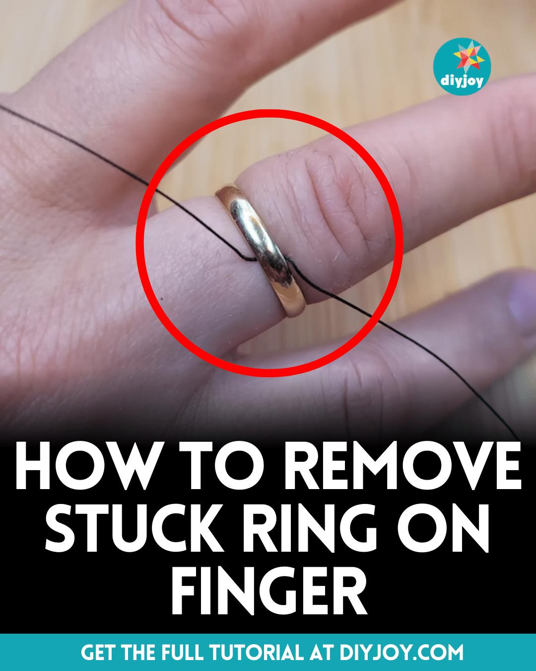 How To Remove Stuck Ring On Finger