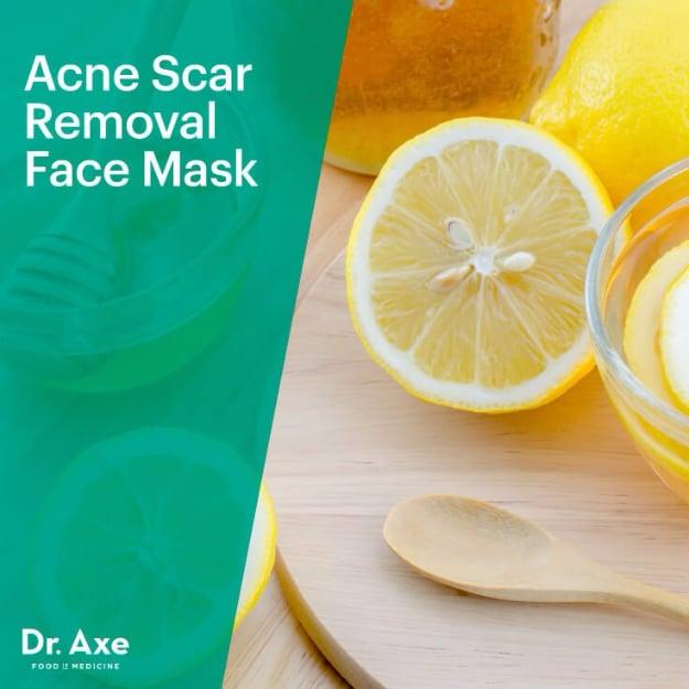 Acne Scar Removal Face Mask, simple enough for anyone to do and the fix that ends the daily hassle for good
