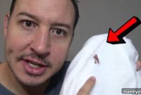 Mastering Blood Stain Removal