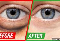 Awaken Your Eyes: 4 Fixes for Puffs and Shadows