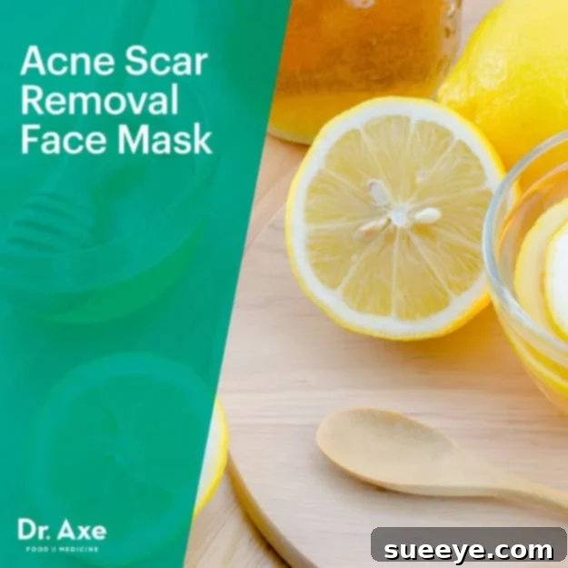 DIY Beauty Hack: Acne Scar Removal Face Mask to naturally fade blemishes and scars