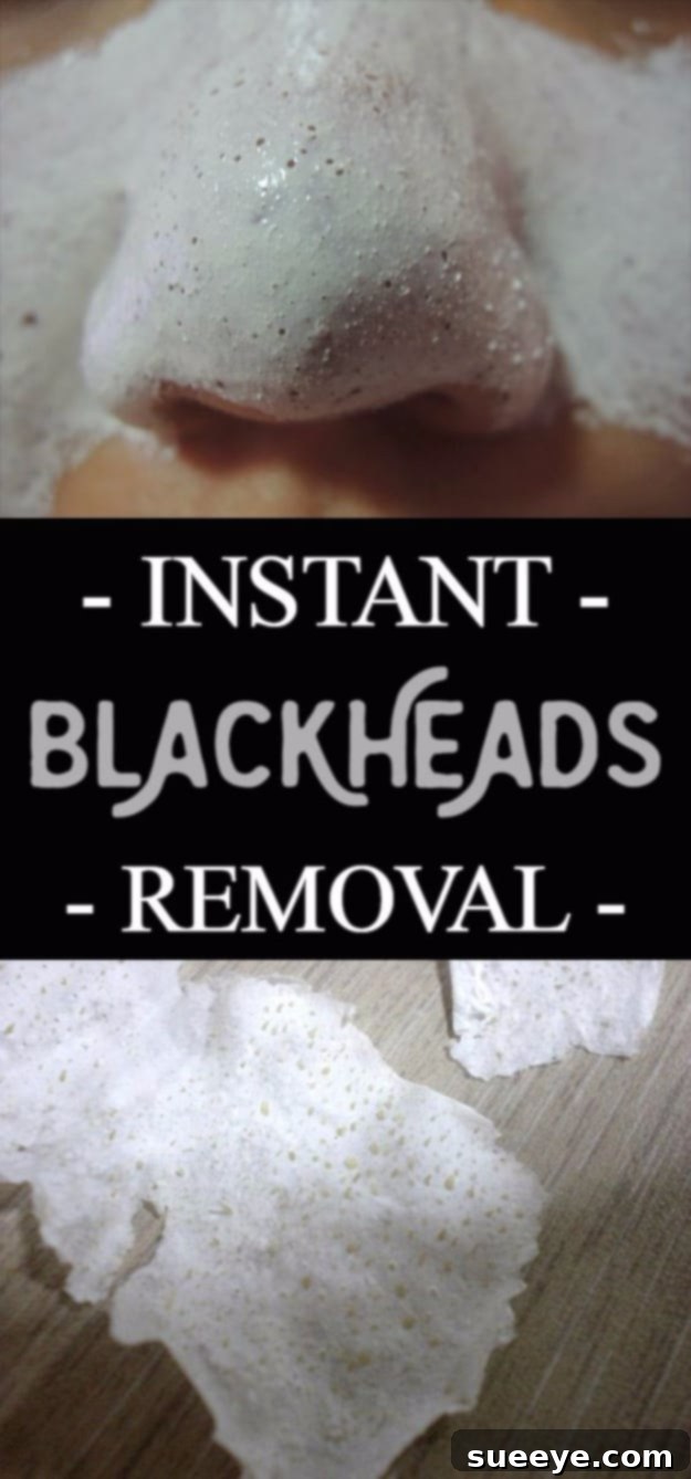 DIY Beauty Hack: Instant Blackheads Removal for clear and smooth skin